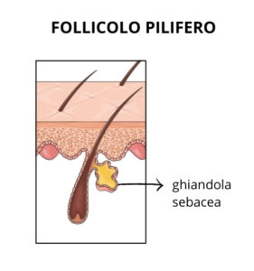 punti neri - follicolo pilifero