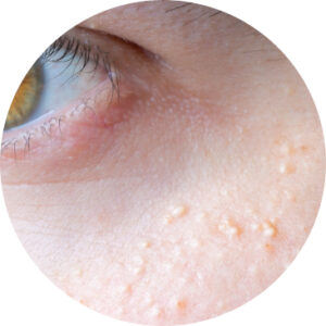 punti neri - grani di miglio