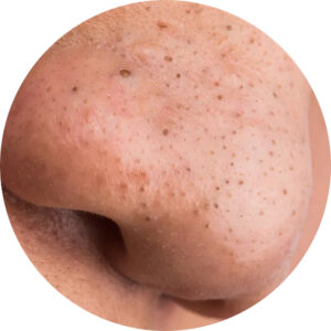 punti neri punti bianchi