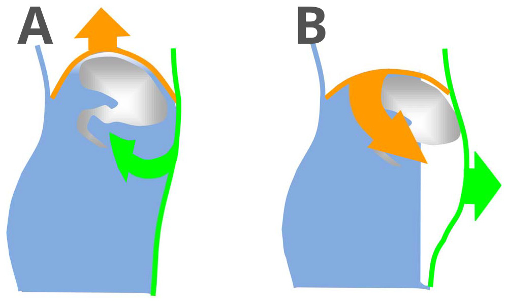 dissinergia addomino-frenica schema