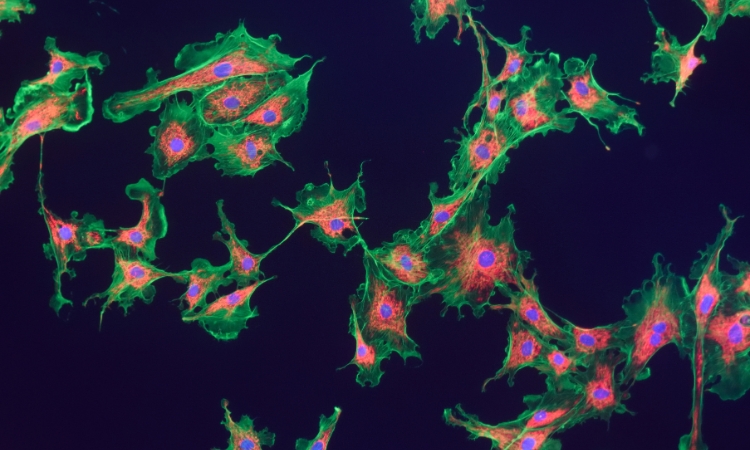 fibroblasti vaginali